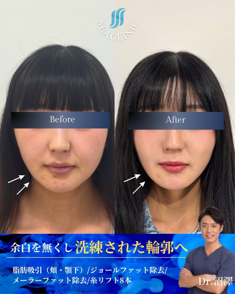 余白を無くし洗練された輪郭へ